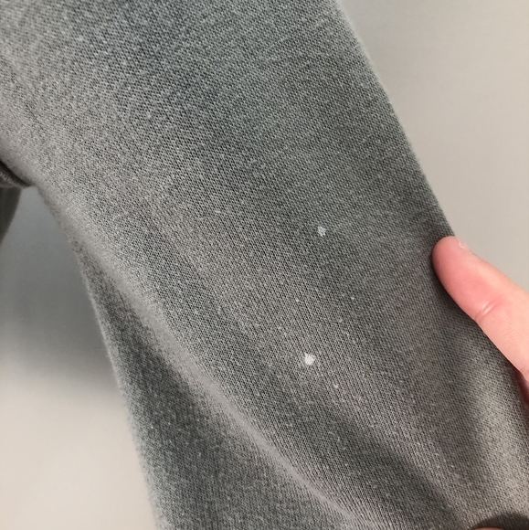 Cropped green zip up from H&M with 2 little each stains on the arm - Picture 5 of 5